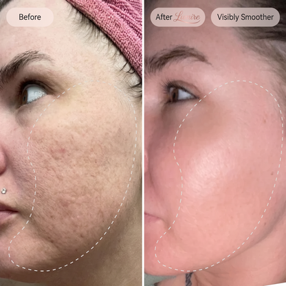Micro-Infusion Rejuvenating Bundle
