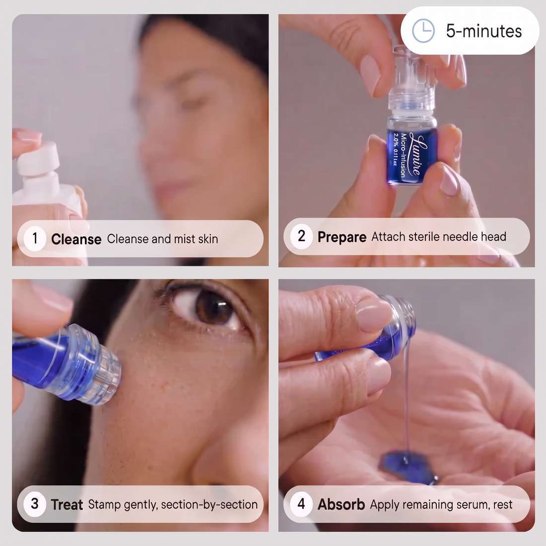 Inside the Micro-Infusion System